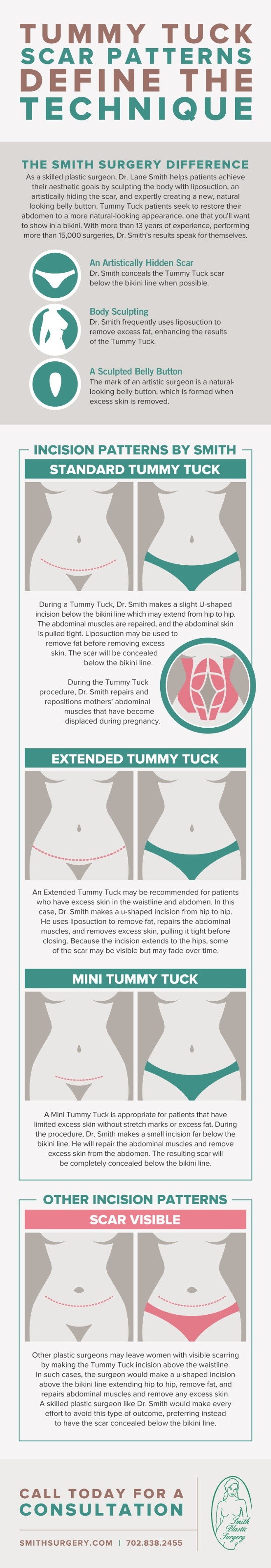 Smith Surgery-Scar patterns and technique infographic